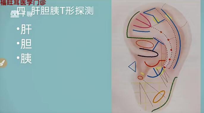 张福旺精讲耳穴诊断班百度网盘