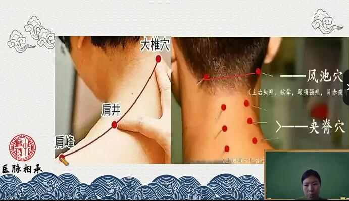 医脉相承王瑶十五组针灸特效方-中医特效针灸教学百度网盘